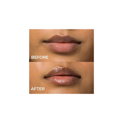Lip Remedy Mask